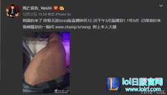 死亡宣告又刚了！连续直播81小时创纪录,lol日服