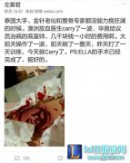 90%选手有健康隐患 几年后职业病会爆发,lol日服